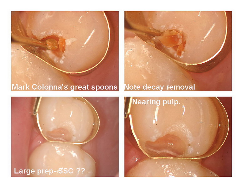 Kiss caries pg 3_resize.jpg